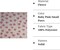 FabricLA Fleece Fabric by The Yard 72"X60" Inch Wide Polar Fleece Soft, Blanket, - Baby Pink Small Paws - 2 Yards